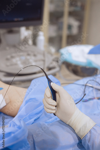 A surgeon holding an catheter equipment for Endovenous Radiofrequency Ablation during vericose veins treatment 