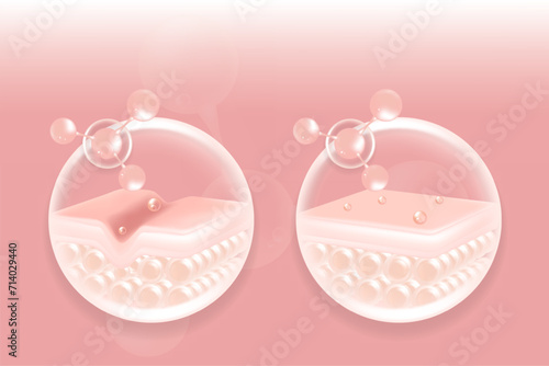 Hyaluronic acid before and after hair and skin solutions ad, pink collagen serum drops into skin cells with cosmetic advertising background ready to use, illustration vector.