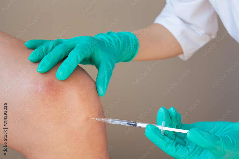 A doctor in green gloves gives a young man an intra-articular injection of hyaluronic acid against osteoarthritis in the knee joint. Preventing the destruction of the knee joint. - obrazy, fototapety, plakaty 