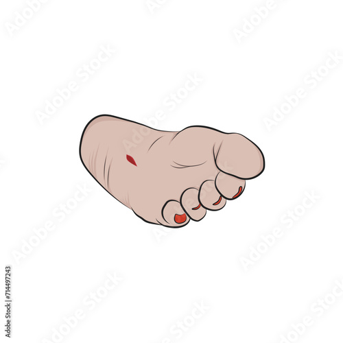 Vector woman's foot with open wound.