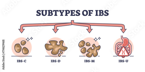 Subtypes of IBS or irritable bower syndrome classification outline diagram, transparent background. Labeled educational scheme.
