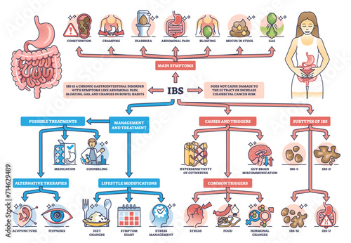 IBS or irritable bower syndrome causes and condition symptoms outline diagram, transparent background. Labeled educational scheme with digestive system chronic problems illustration.