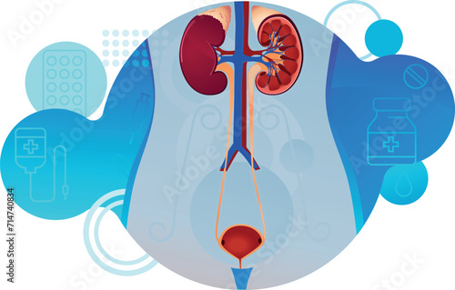 urinary system - image of patient's kidneys	