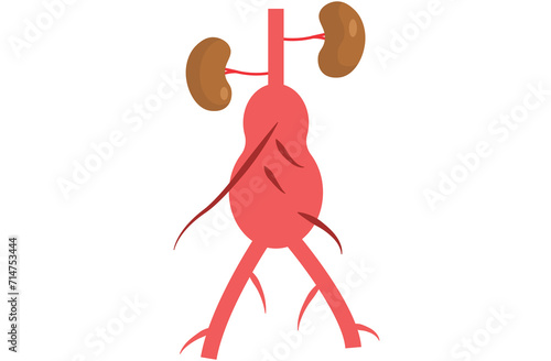 abdominal aortic aneurysm,heart aorta attack, aortic arch bulge open,vein clots stent stroke Marfan root left graft, hernia vessel pain High blood kidney damage Turner,red,pink,purple