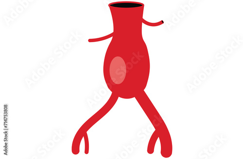 abdominal aortic aneurysm,heart aorta attack, aortic arch bulge open,vein clots stent stroke Marfan root left graft, hernia vessel pain High blood kidney damage Turner,red,pink,purple