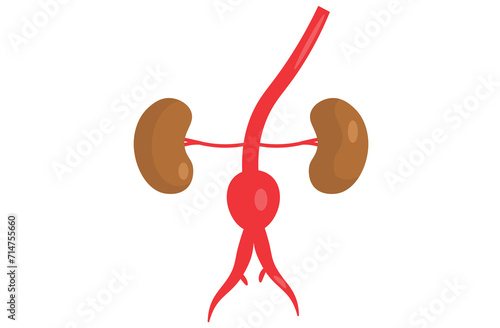 abdominal aortic aneurysm,heart aorta attack, aortic arch bulge open,vein clots stent stroke Marfan root left graft, hernia vessel pain High blood kidney damage Turner,red,pink,purple