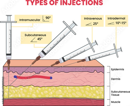 illustration of injection types infographic
