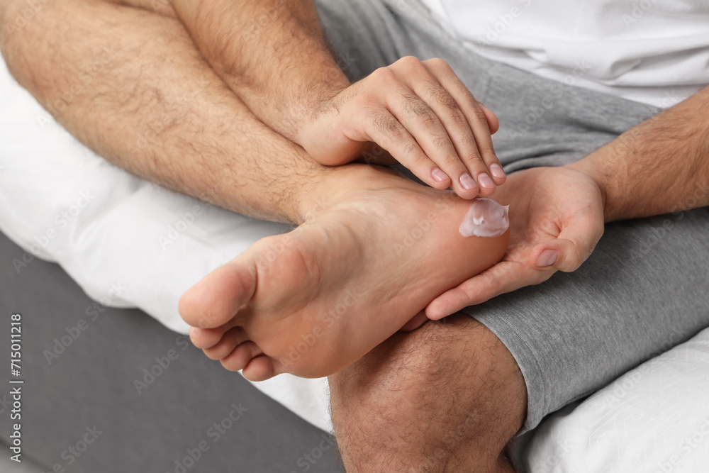 Fototapeta premium Man with dry skin applying cream onto his foot on bed, closeup