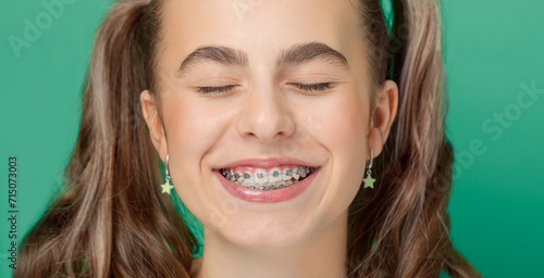 Portrait of smiling beautiful teenage girl with braces  pointing fingers at her charming smile.