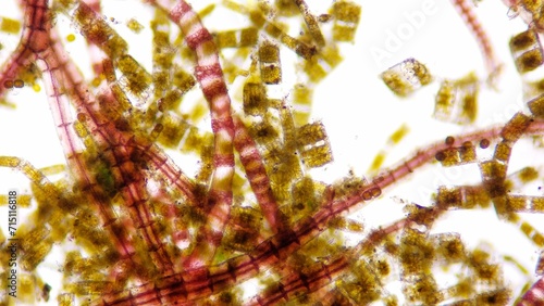Marine diatom, Biddulphia sp. Algae blooming. Live-cell. Selective focus image