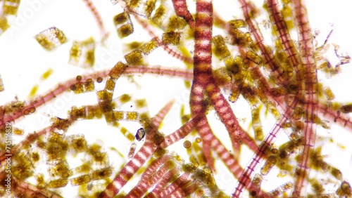 Marine diatom, Biddulphia sp. Algae blooming. Live-cell. Selective focus image