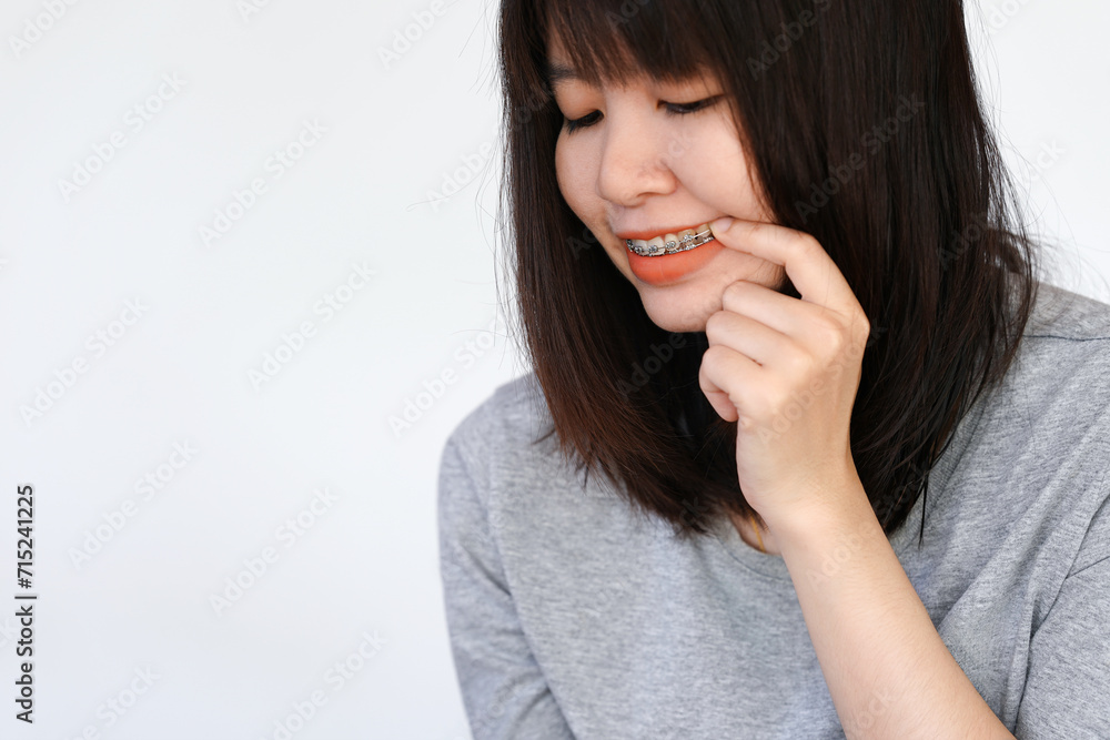 Woman wearing braces and pointing at braces due to pain from. Woman wearing braces and pointing at braces due to pain from.