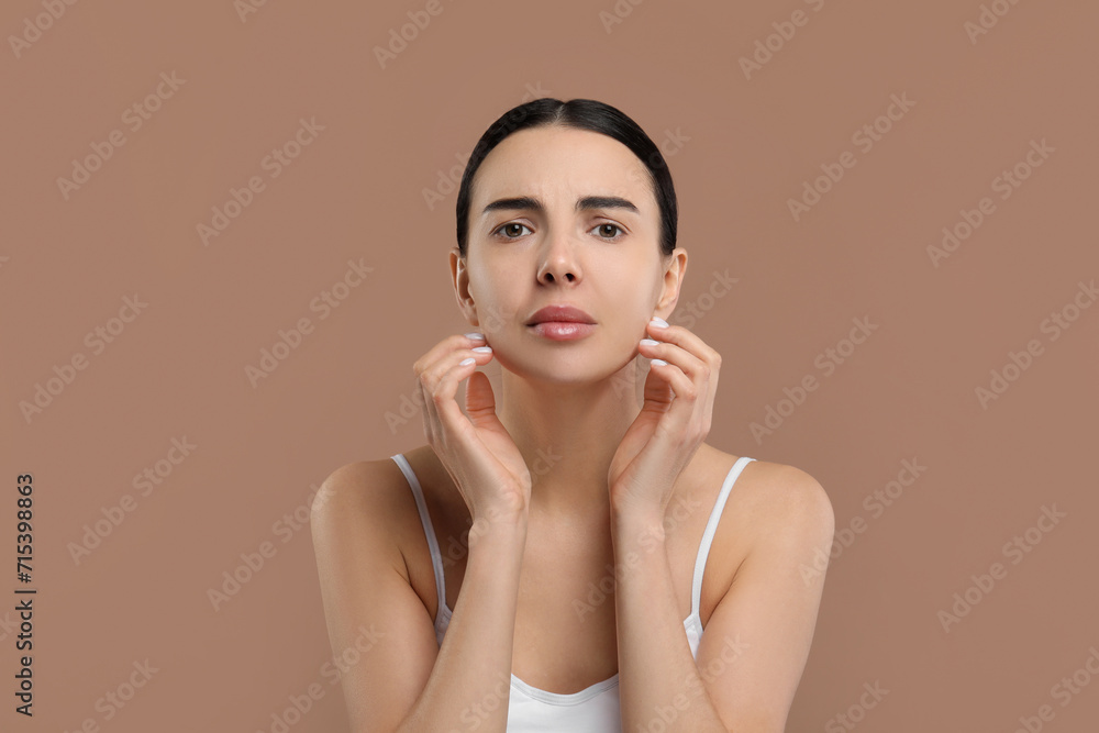 Woman with dry skin on beige background Woman with dry skin on beige background