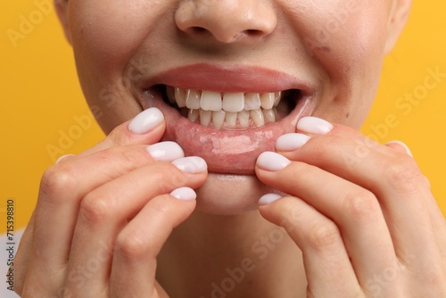 Woman showing her clean teeth on yellow background, closeup