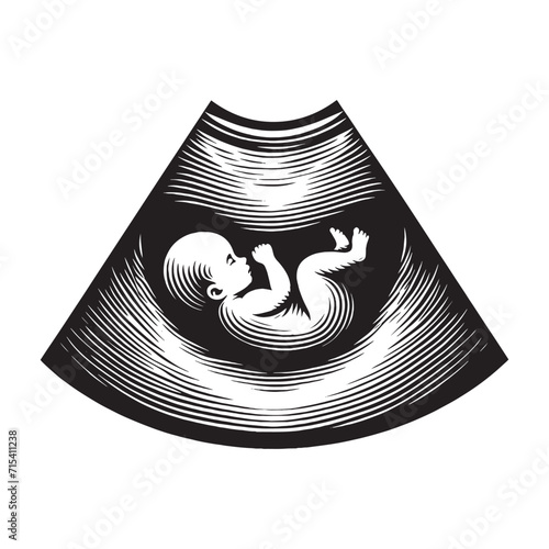 Ultrasound.  Baby in pregnant belly. Simple vector black line  illustration, icon, label