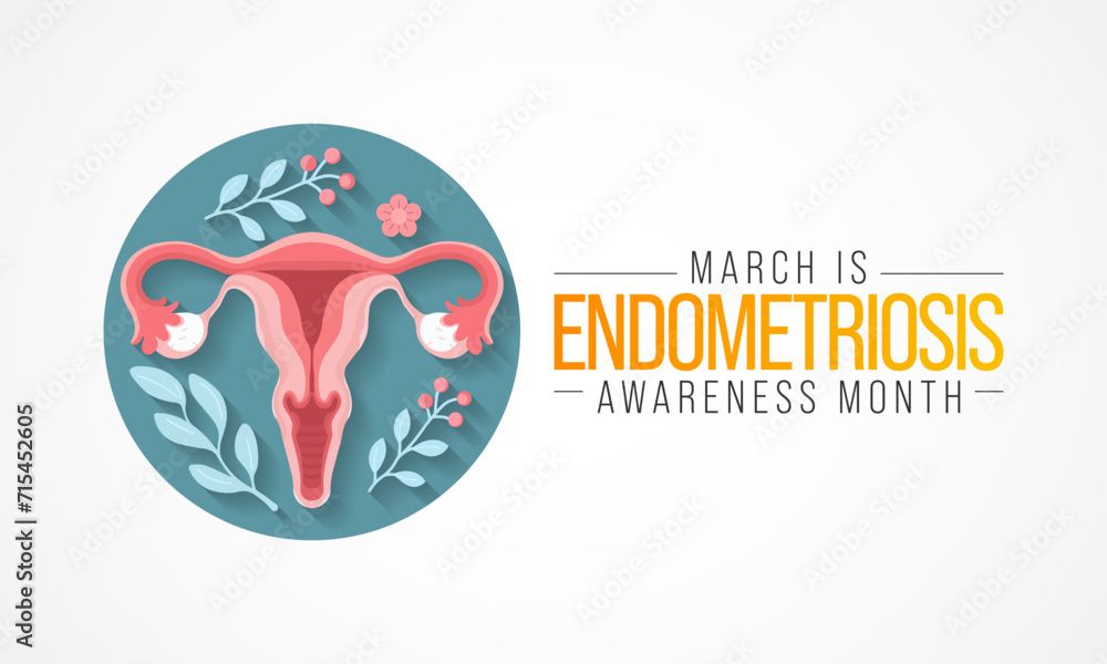 Endometriosis awareness month is observed every year in March, is a painful condition where endometrial tissue grows outside the uterus. Vector illustration - obrazy, fototapety, plakaty 