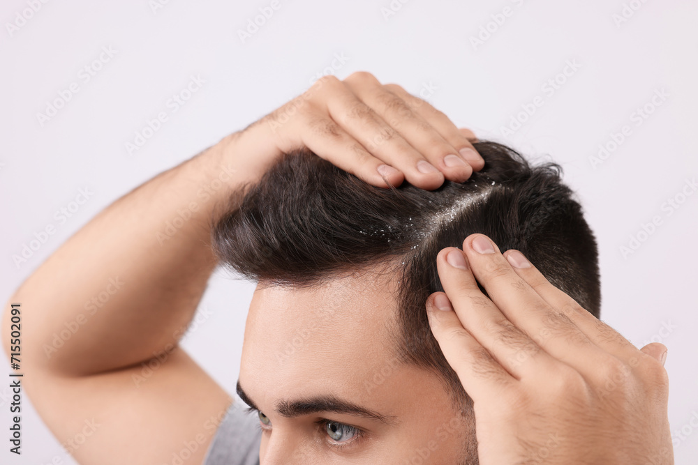Fototapeta premium Man with dandruff in his dark hair on light grey background, closeup