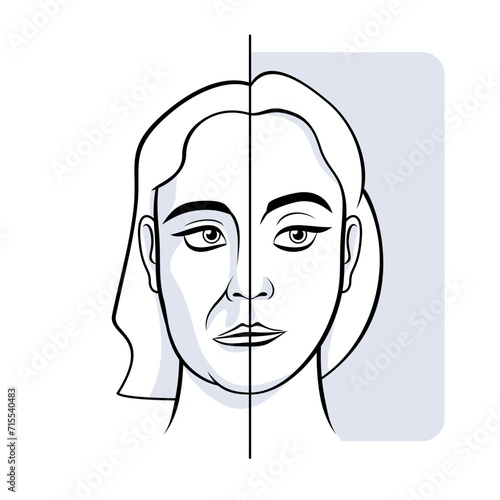 Woman face sagging jowls before after vector illustration
