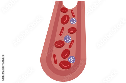 leukemia. Blood cancer. Red and white blood cells. Isolated vector illustrations in cartoon style.normal blood and leukemia.Red and white Blood,Leukemia icon. White and red blood cells,red