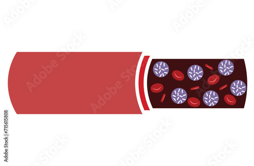 leukemia. Blood cancer. Red and white blood cells. Isolated vector illustrations in cartoon style.normal blood and leukemia.Red and white Blood,Leukemia icon. White and red blood cells,red