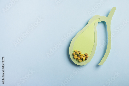 Gallbladder decorative model with gallstones on pastel blue background. Gallbladder disease concept. Top view, copy space