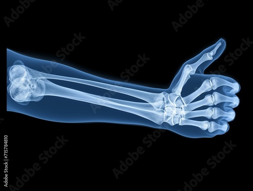 Success symbol, x-ray image of a forearm and hand with thumb up and folded fingers, ok radiography photograph, illustration of achievement, positive results or answer, problem solved, approval sign photo