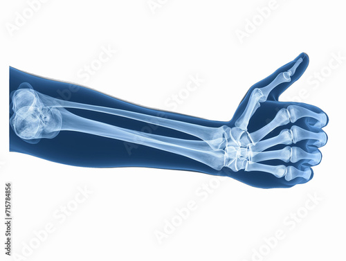 Success symbol, x-ray image of a forearm and hand with thumb up and folded fingers, forearm bones radius and ulna as well as carpals, metacarpals and phalanges are visible, ok radiography photograph photo