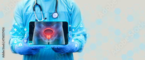 The doctor analyzes the simple x-ray of the male pelvis. the bladder and prostate are observed. Prostate cancer, bladder cancer, men's healthcare. Urologist with tablet.