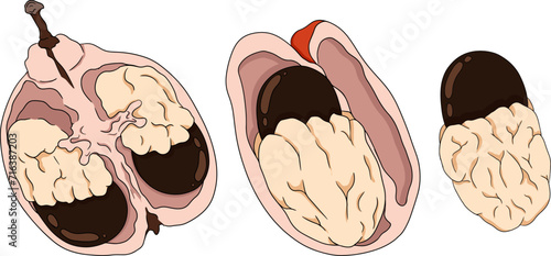 Hand drawn colored Ackee, Blighia sapida or achee, medicinal plant. Vector Illustration on white Background.