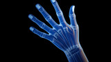 3d rendered illustration of an arthritic hand isolated on black background