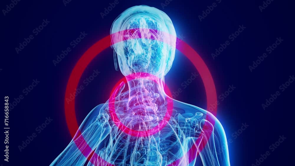 Abstract animation of a woman and a sore throat Abstract animation of a woman and a sore throat