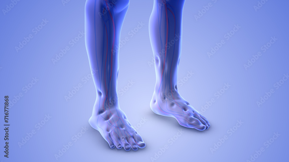 Lower limb edema or leg swelling Lower limb edema or leg swelling