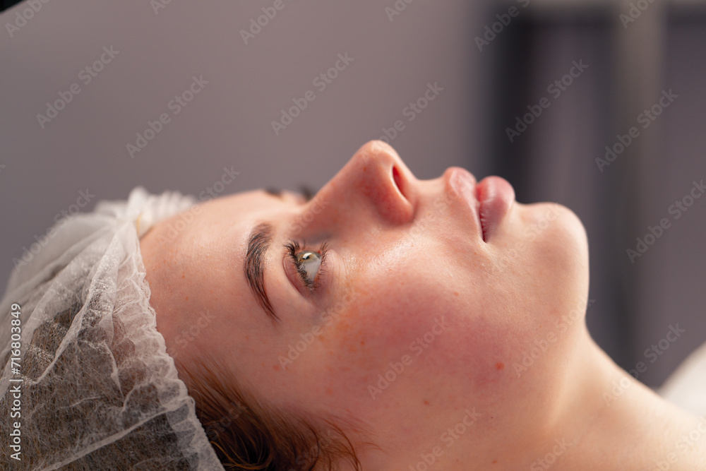 close-up of a client's face during health rejuvenation beauty procedure in a beauty salon skin care