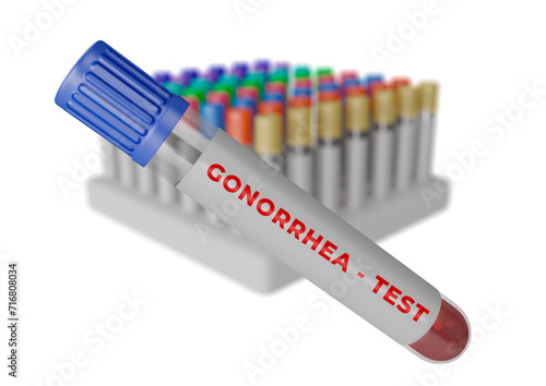 Human blood sample in the tube for gonorrhea test