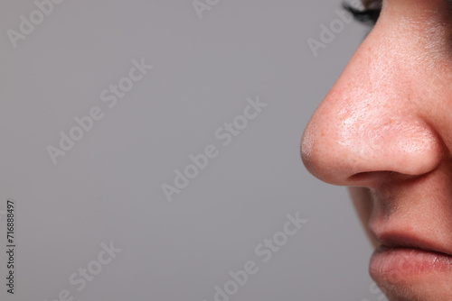 Closeup view of woman with unhealthy skin on grey background, space for text