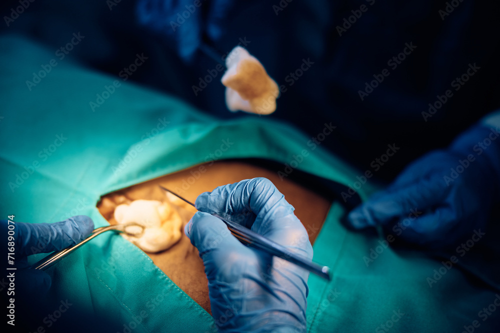 Close up of surgical procedure in hospital. Close up of surgical procedure in hospital.