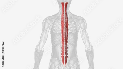 The transversospinalis muscle group is the deep layer of the intrinsic back muscles .