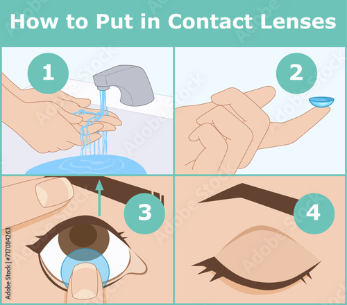How to put in contact lenses. Instruction, infographic. Healthcare illustration. Vector illustration. 