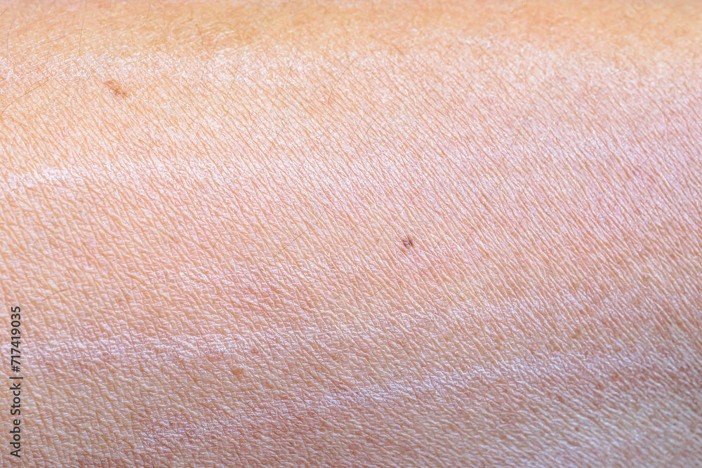 Fototapeta premium dry and dehydrated human skin texture background