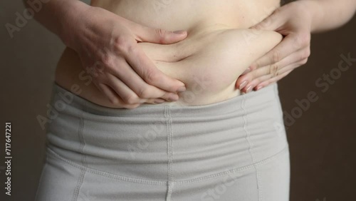 A fat woman in white trousers touches the fat folds on her stomach, close-up. Lifestyle, diet concept, weight loss, obesity, lack of exercise. Woman after childbirth.  photo