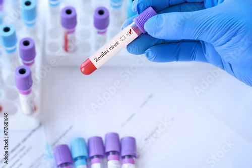 Doctor holding a test blood sample tube with positive Zombie virus test on the background of medical test tubes with analyzes.