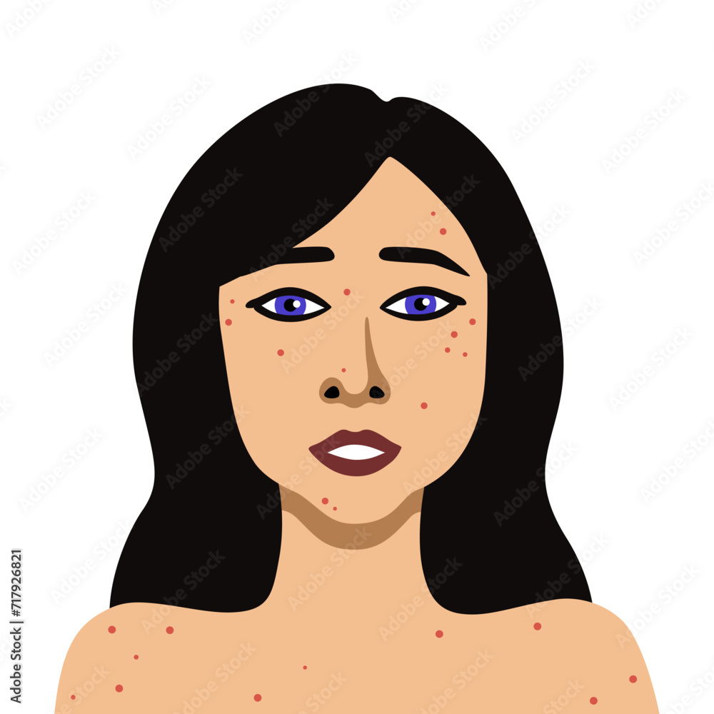 Vector image of portrait young woman with acne minimalistic Vector image of portrait young woman with acne minimalistic