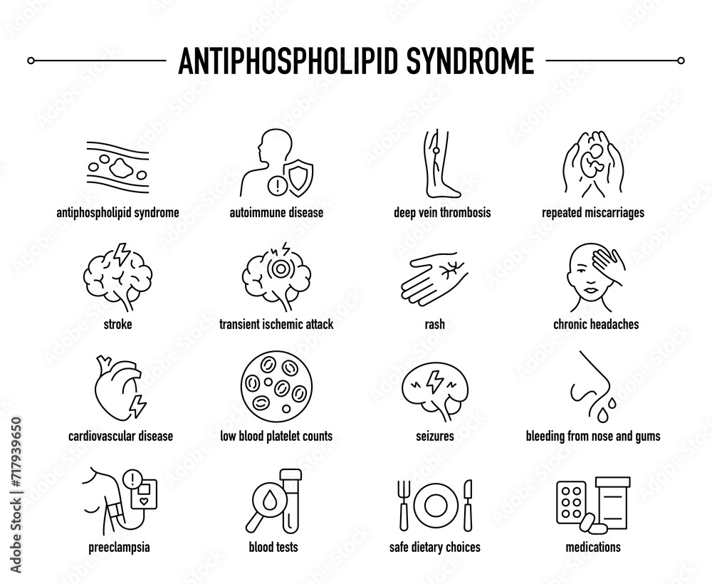 Antiphospholipid Syndrome Symptoms Diagnostic And Treatment Vector Antiphospholipid syndrome symptoms diagnostic and treatment vector