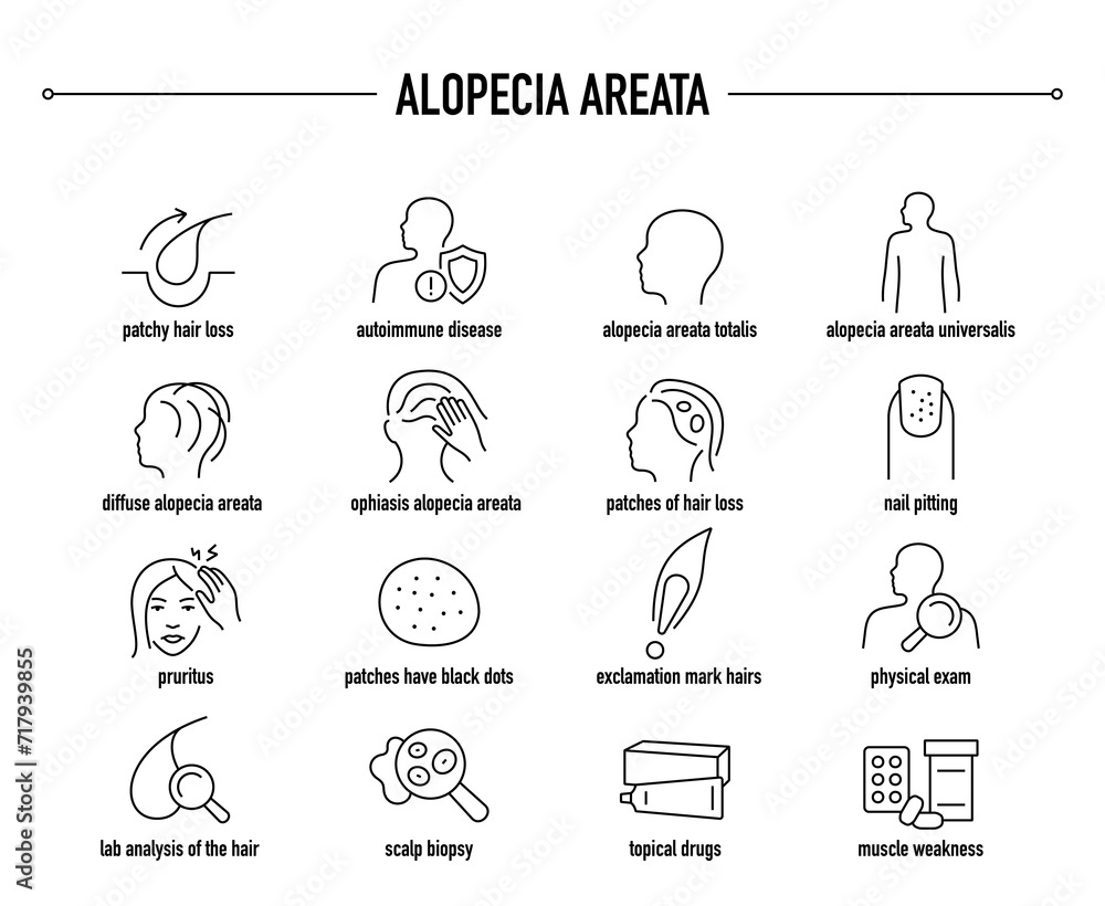 Alopecia Areata symptoms, diagnostic and treatment vector icons. Line editable medical icons.