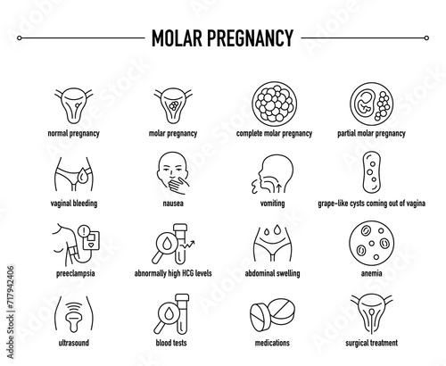 Molar Pregnancy symptoms, diagnostic and treatment vector icons. Line editable medical icons.