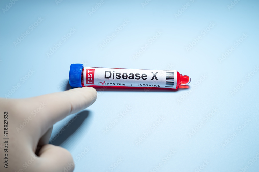 Fototapeta premium Background of Disease X.Disease X is an unknown pathogen that could cause a serious international epidemic.Medical health concept.