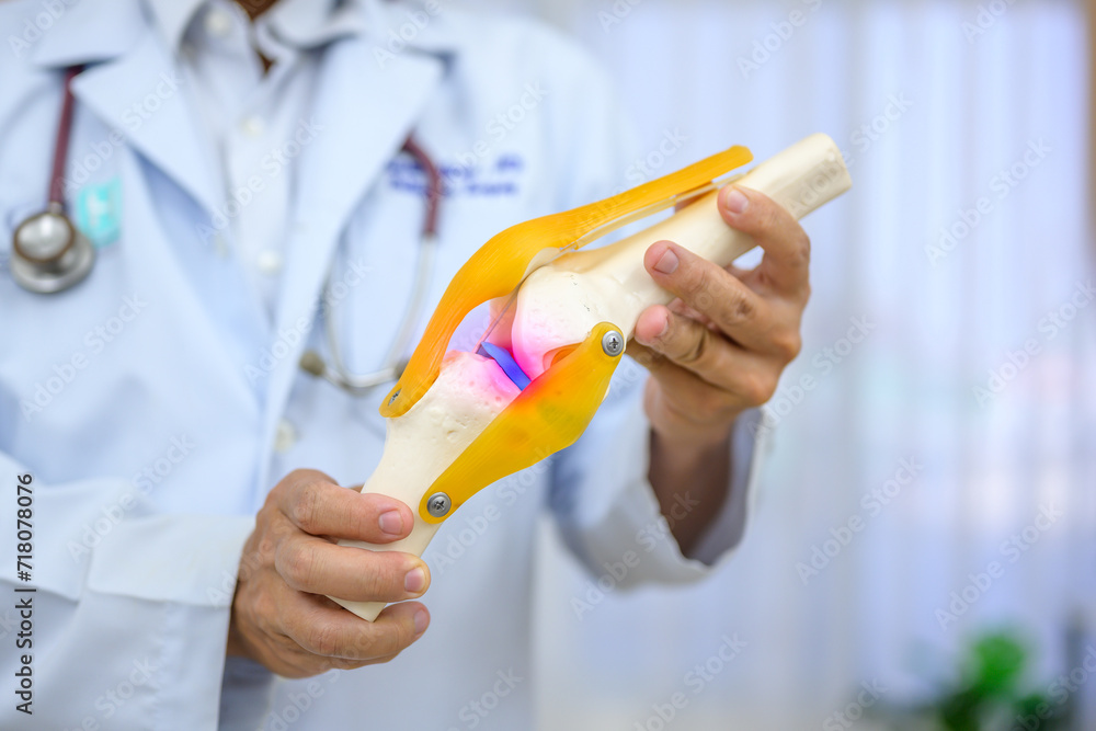 Φωτογραφία An orthopedic surgeon demonstrating treatment of a human cruciate ligament injury in a knee-joint medical teaching model