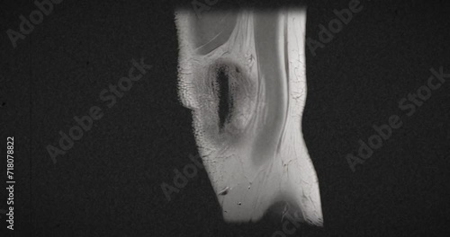 Vintage textured  MRI scan of an injured male knee, after excess basketball playing. Scanning side to side. photo