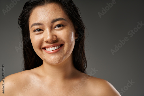 skin issues concept, happy young asian woman with pimples on wet skin smiling on grey background photo