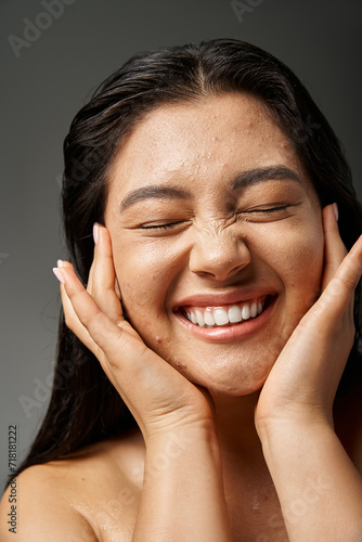 Fotografía joyful and young asian woman with brunette hair and acne prone skin smiling on g